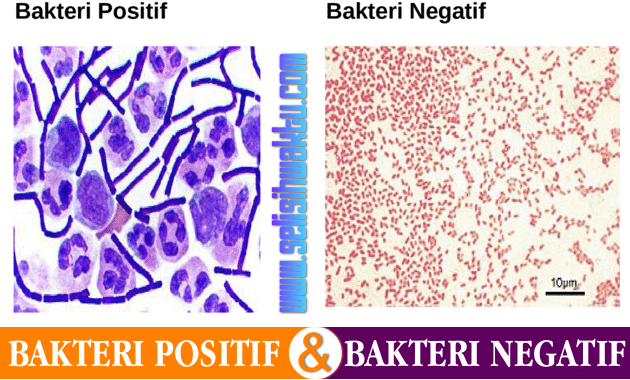 GRAM POSITIF DAN NEGATIF PADA BAKTERI